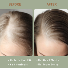 Load image into Gallery viewer, Adult Women's Hair Loss Treatment