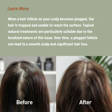 Load image into Gallery viewer, Adult Women's Hair Loss Treatment